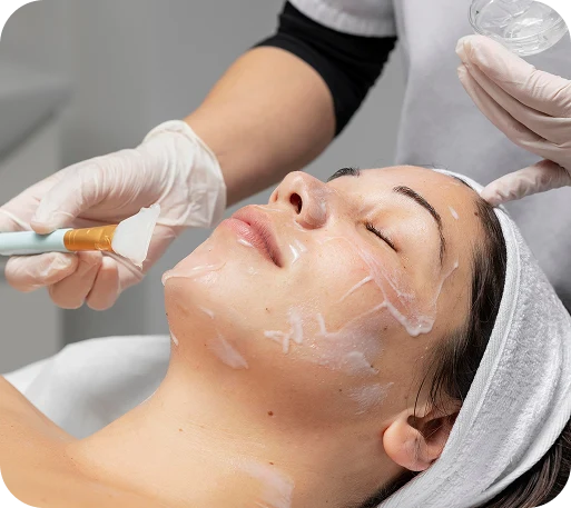 Qu’est-ce qu’un peeling chimique